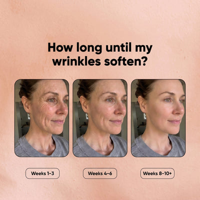 Anti-Wrinkle Serum